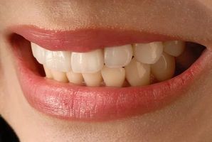 пасти за зъби без флуор - 5918 постижения